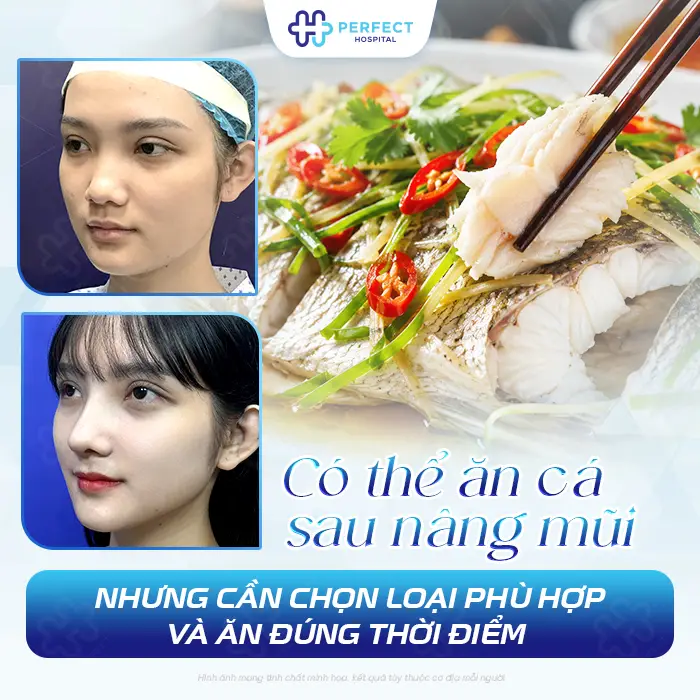 Nâng Mũi Có Được Ăn Cá Không? Có Nên Ăn Ngay Sau Phẫu Thuật