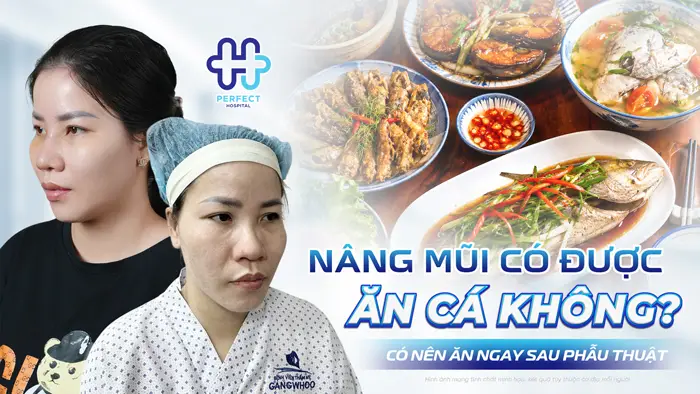 Nâng Mũi Có Được Ăn Cá Không? Có Nên Ăn Ngay Sau Phẫu Thuật