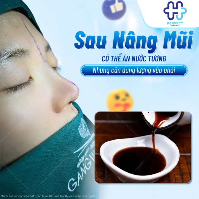 Nâng Mũi Có Ăn Nước Tương Được Không? Bác Sĩ Giải Đáp Chi Tiếtg
