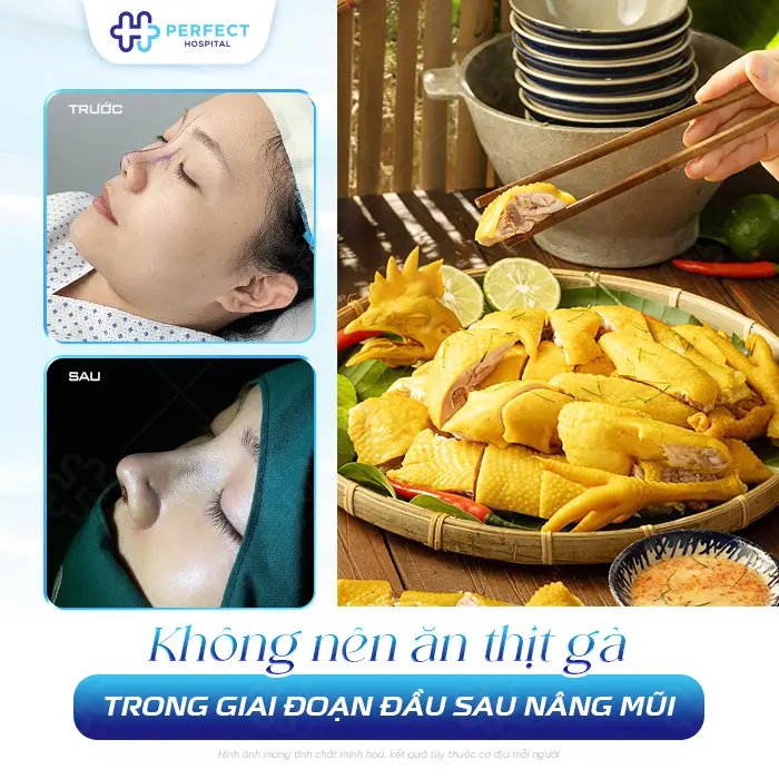 Nâng Mũi Có Được Ăn Thịt Gà Không? Kiêng Bao Lâu Là An Toàn