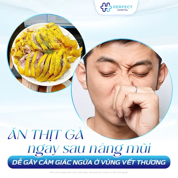 Nâng Mũi Có Được Ăn Thịt Gà Không? Kiêng Bao Lâu Là An Toàn