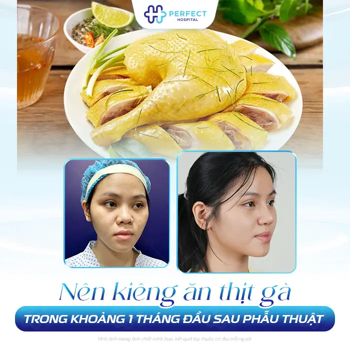 Nâng Mũi Có Được Ăn Thịt Gà Không? Kiêng Bao Lâu Là An Toàn