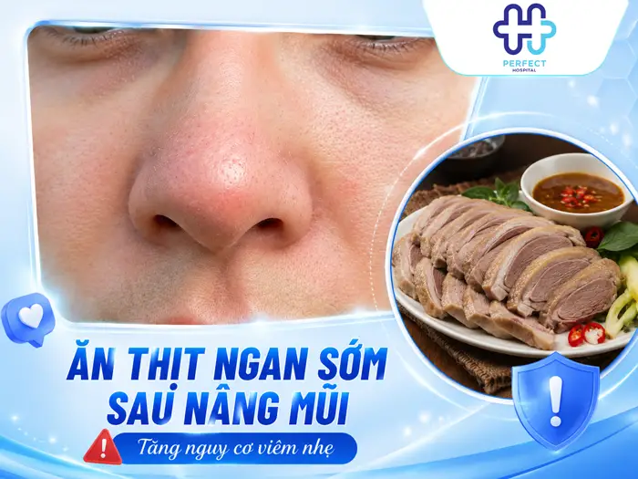 Nâng Mũi Có Ăn Được Thịt Ngan Không? Bao Lâu Thì Ăn Lại An Toàn