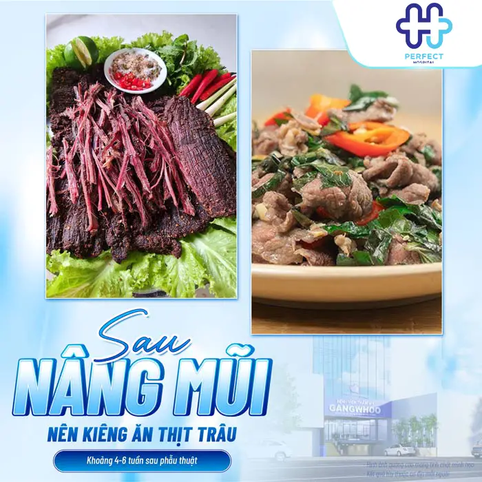 Nâng Mũi Có Ăn Được Thịt Trâu Không? Giải Đáp Từ Perfect Hospital