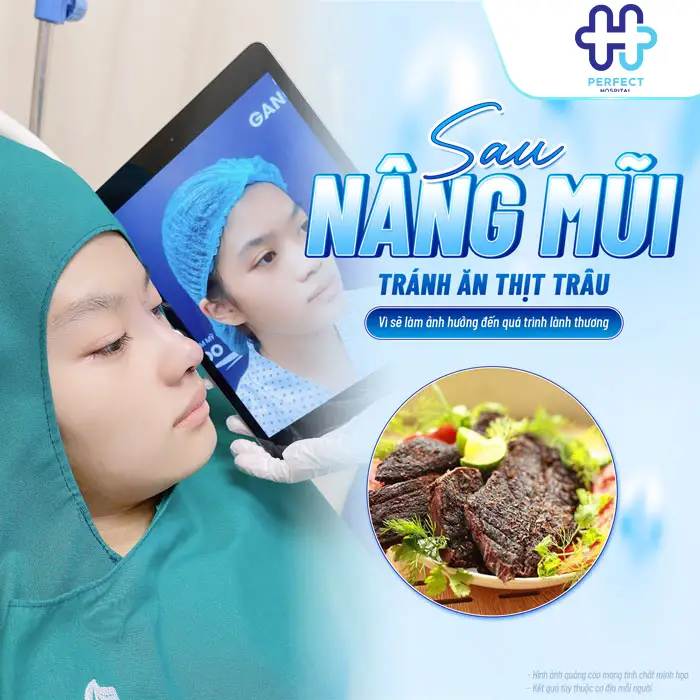 Nâng Mũi Có Ăn Được Thịt Trâu Không? Giải Đáp Từ Perfect Hospital