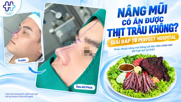 Nâng Mũi Có Ăn Được Thịt Trâu Không? Giải Đáp Từ Perfect Hospital