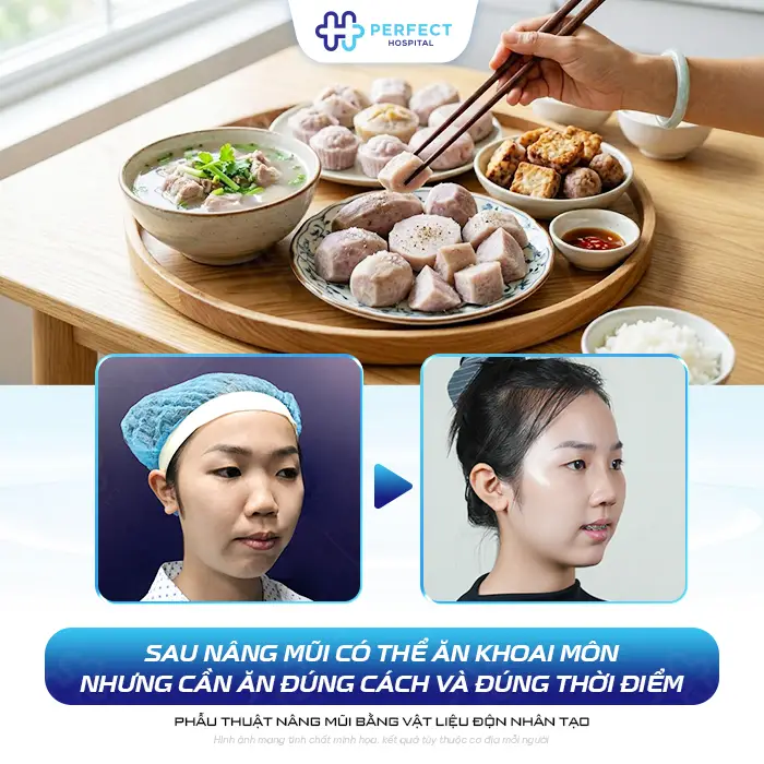 Nâng Mũi Có Ăn Khoai Môn Được Không? Kiêng Gì Để Nhanh Lành