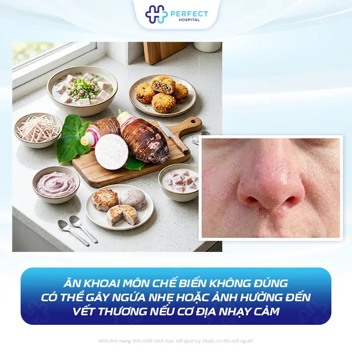 Nâng Mũi Có Ăn Khoai Môn Được Không? Kiêng Gì Để Nhanh Lành
