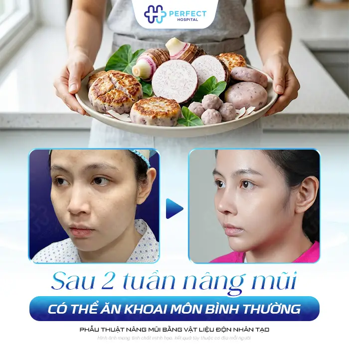 Nâng Mũi Có Ăn Khoai Môn Được Không? Kiêng Gì Để Nhanh Lành