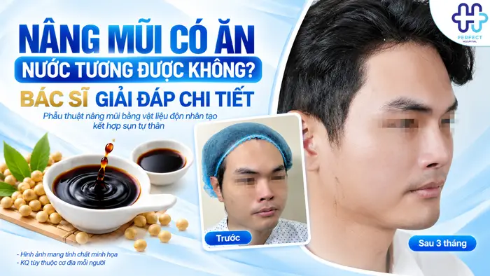 Nâng Mũi Có Ăn Nước Tương Được Không? Bác Sĩ Giải Đáp Chi Tiếtg