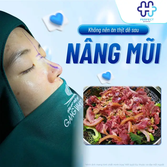 Nâng Mũi Có Ăn Thịt Dê Được Không? Bác Sĩ Perfect Hospital Giải Đáp
