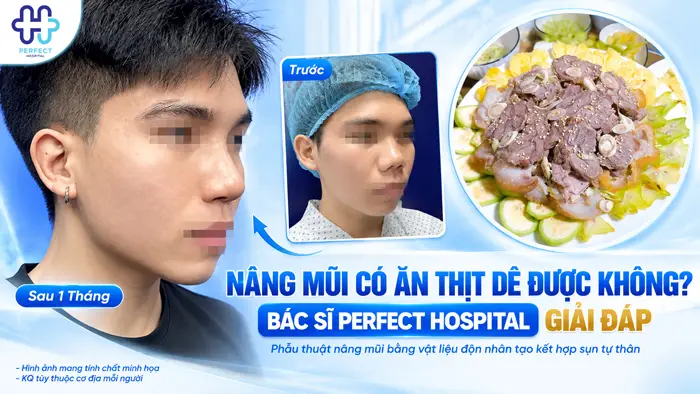 Nâng Mũi Có Ăn Thịt Dê Được Không? Bác Sĩ Perfect Hospital Giải Đáp