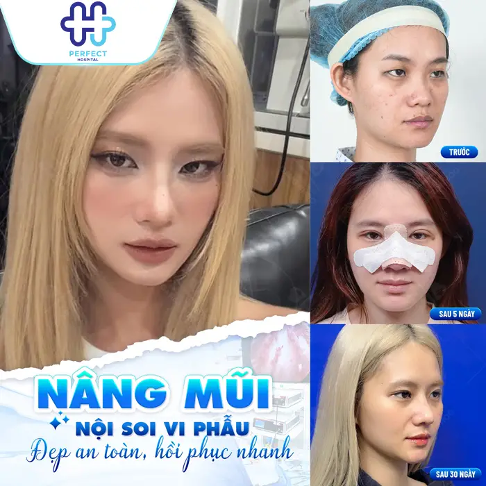 Nâng mũi có ảnh hưởng gì không? Có hại về sau không?
