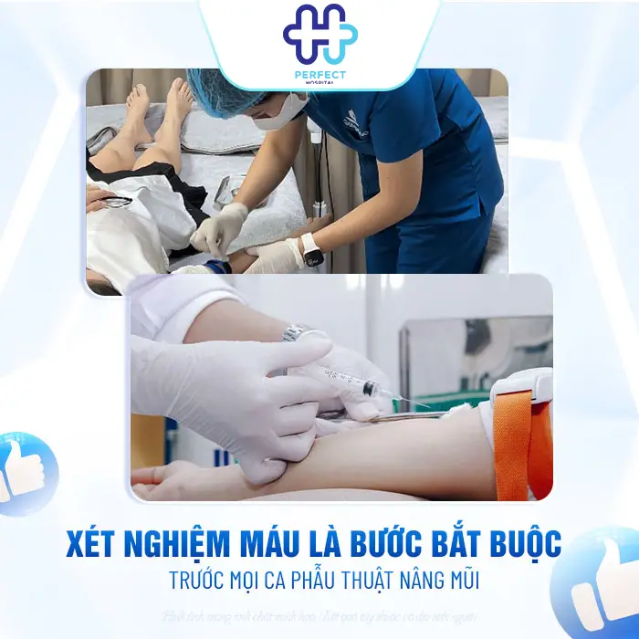 Nâng Mũi Có Cần Xét Nghiệm Máu Không? Cần Lưu Ý Gì?