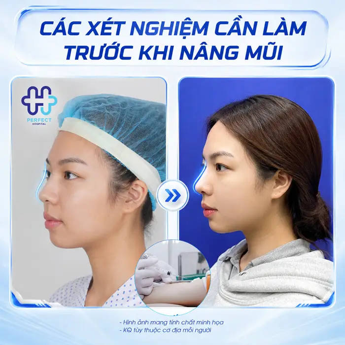 Nâng Mũi Có Cần Xét Nghiệm Máu Không? Cần Lưu Ý Gì?