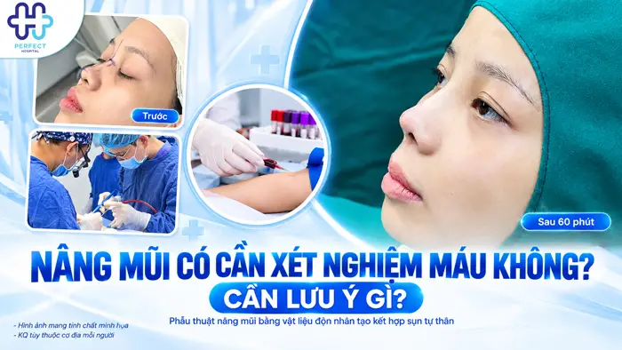 Nâng Mũi Có Cần Xét Nghiệm Máu Không? Cần Lưu Ý Gì?