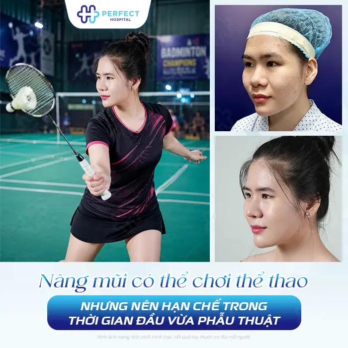 Nâng Mũi Có Chơi Thể Thao Được Không? Khi Nào Tập Lại An Toàn