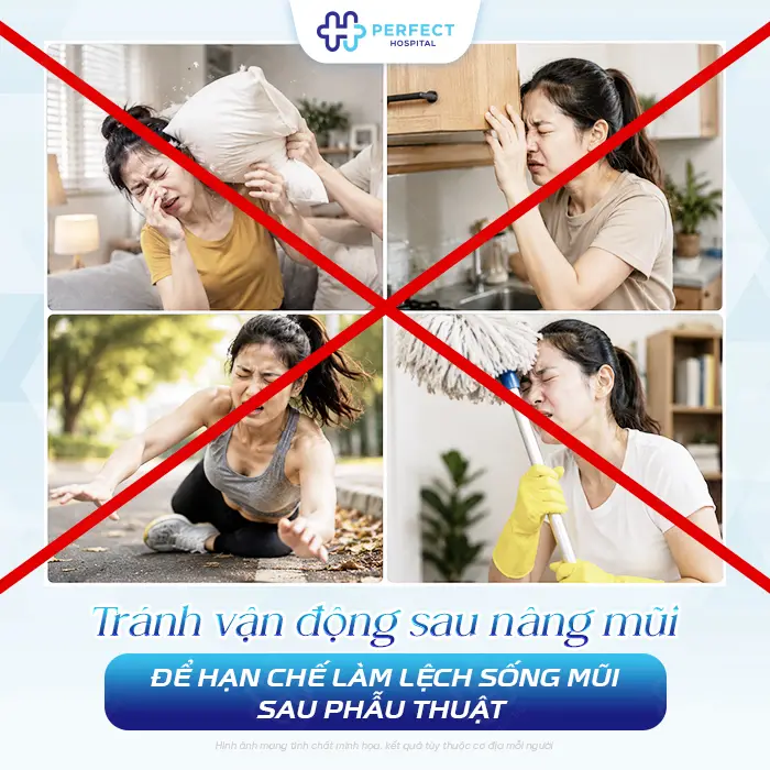 Nâng Mũi Có Chơi Thể Thao Được Không? Khi Nào Tập Lại An Toàn