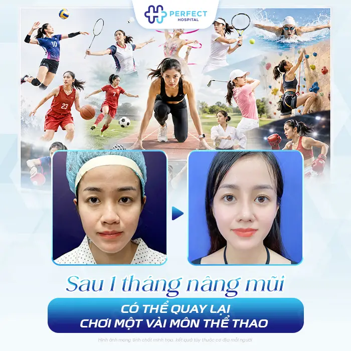 Nâng Mũi Có Chơi Thể Thao Được Không? Khi Nào Tập Lại An Toàn