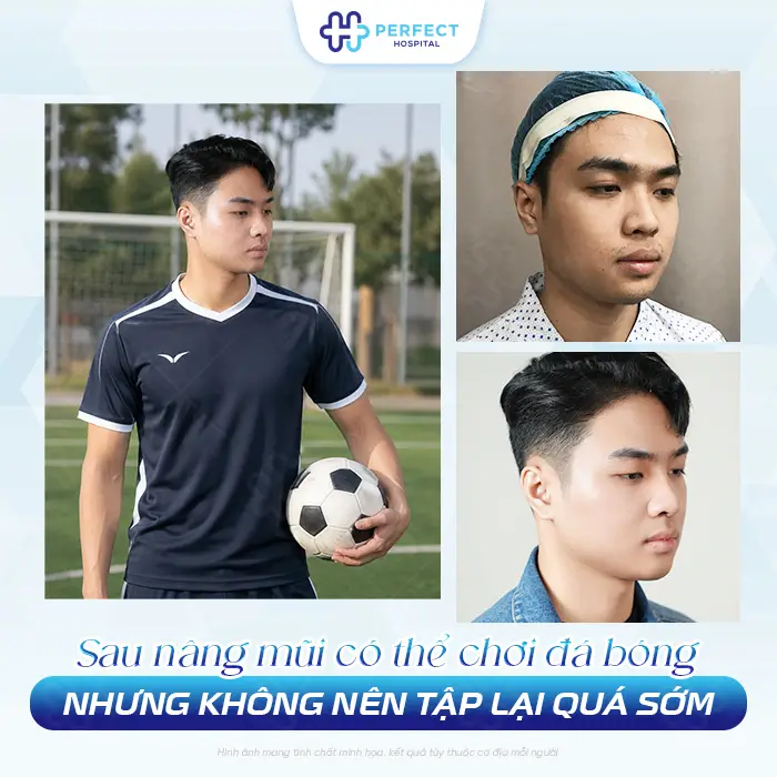 Nâng Mũi Có Đá Bóng Được Không? Bao Lâu Tập Lại An Toàn