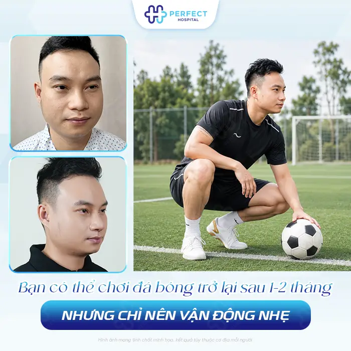 Nâng Mũi Có Đá Bóng Được Không? Bao Lâu Tập Lại An Toàn
