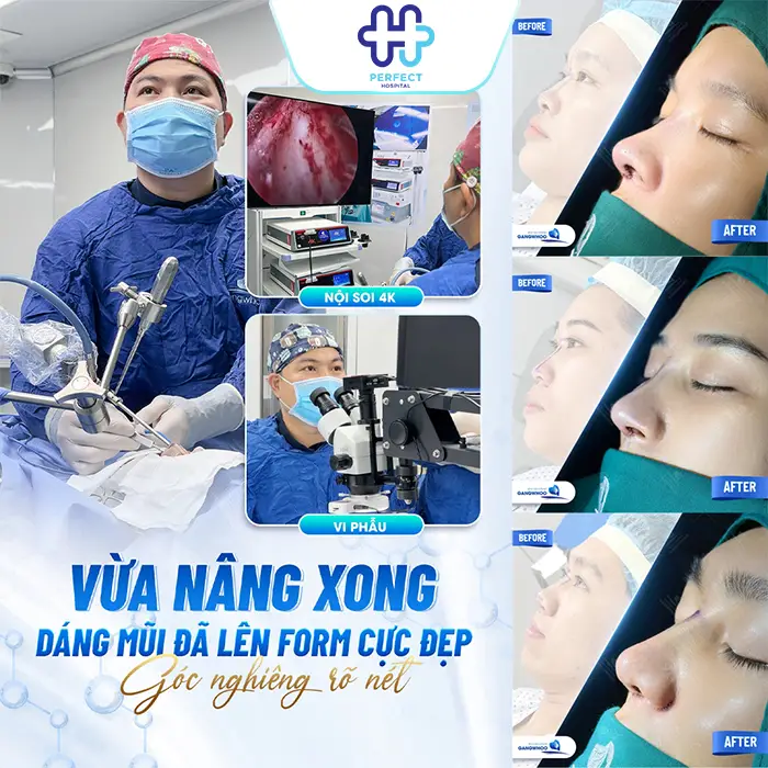 Nâng Mũi Có Để Lại Sẹo Không? Cách Tránh Sẹo Lồi Hiệu Quả