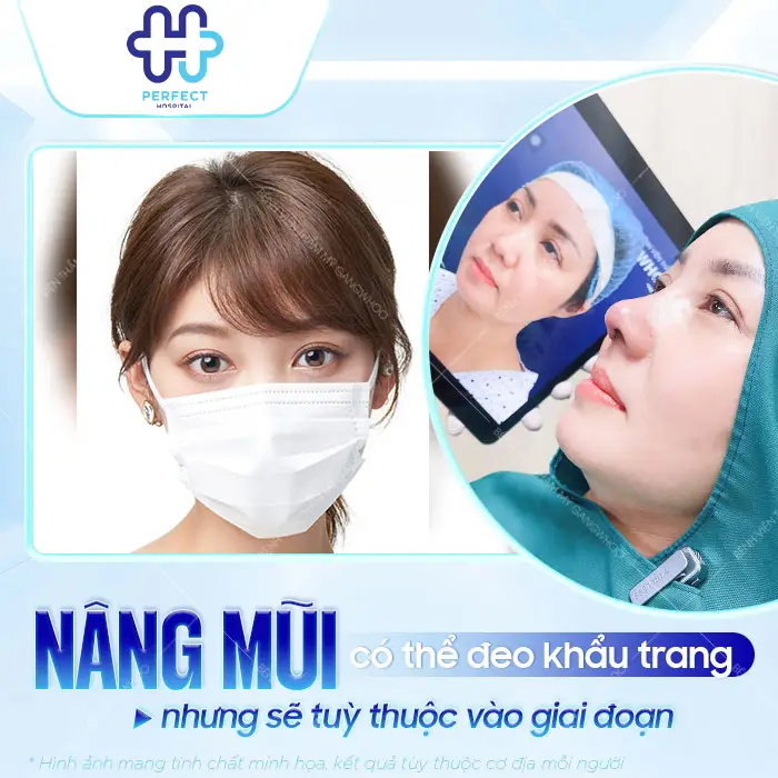 Nâng Mũi Có Đeo Khẩu Trang Được Không? Bác Sĩ Giải Đáp Chi Tiết