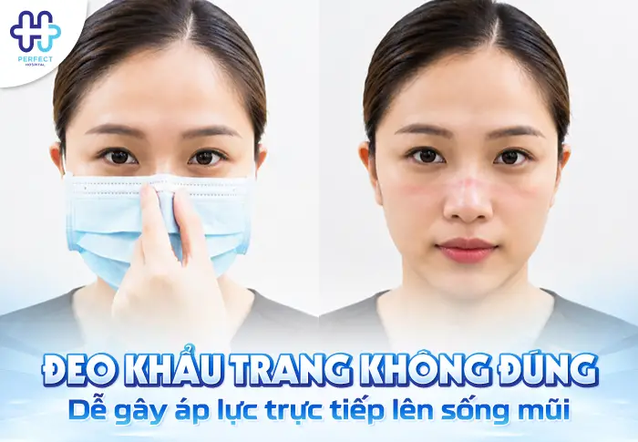 Nâng Mũi Có Đeo Khẩu Trang Được Không? Bác Sĩ Giải Đáp Chi Tiết