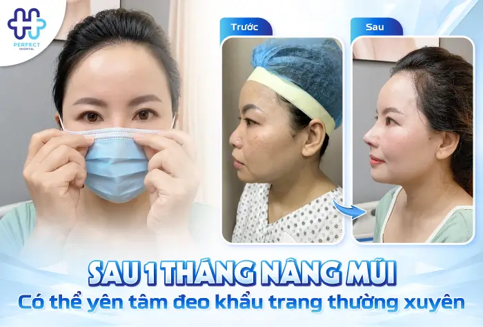 Nâng Mũi Có Đeo Khẩu Trang Được Không? Bác Sĩ Giải Đáp Chi Tiết
