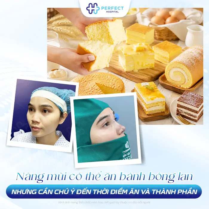 Nâng Mũi Có Được Ăn Bánh Bông Lan Không? Khi Nào Nên Ăn