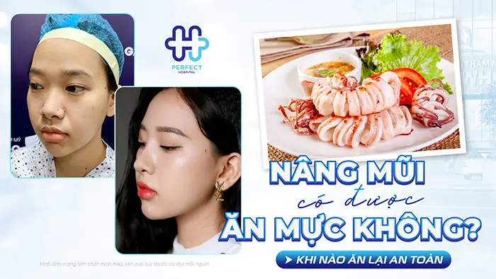 Nâng Mũi Có Được Ăn Mực Không Và Khi Nào Ăn Lại An Toàn
