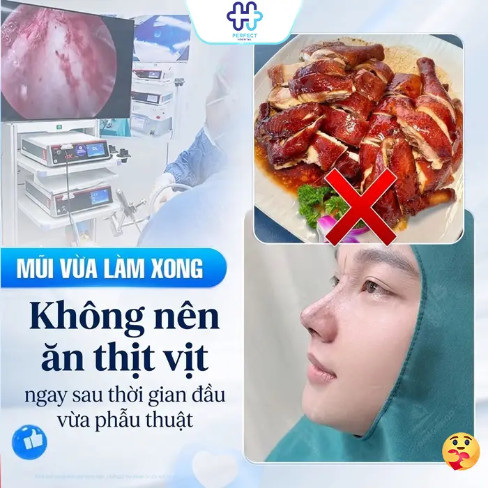 Nâng Mũi Có Được Ăn Thịt Vịt Không? Bao Lâu Thì Ăn Lại Được?