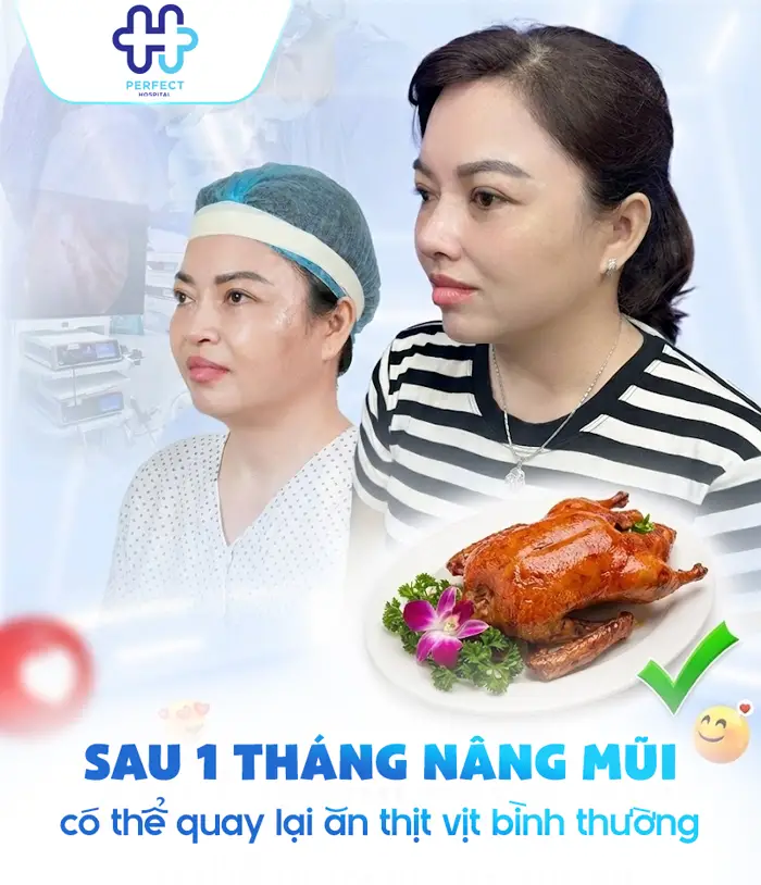 Nâng Mũi Có Được Ăn Thịt Vịt Không? Bao Lâu Thì Ăn Lại Được?