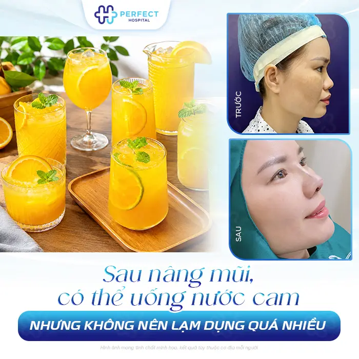 Nâng Mũi Có Được Uống Nước Cam Không? Bác Sĩ Giải Đáp Chi Tiết