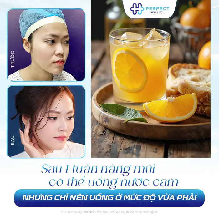 Nâng Mũi Có Được Uống Nước Cam Không? Bác Sĩ Giải Đáp Chi Tiết