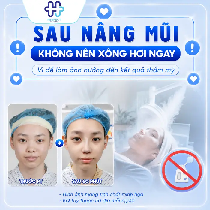 Nâng mũi có được xông mặt không? Cần lưu ý những gì