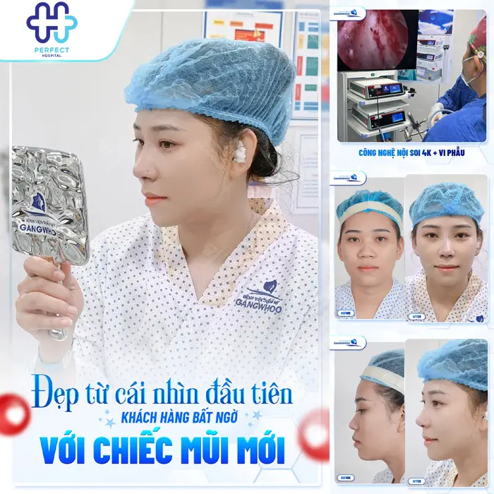 Nâng Mũi Có Nên Cắt Cánh Mũi Không? Khi Nào Cần Kết Hợp?