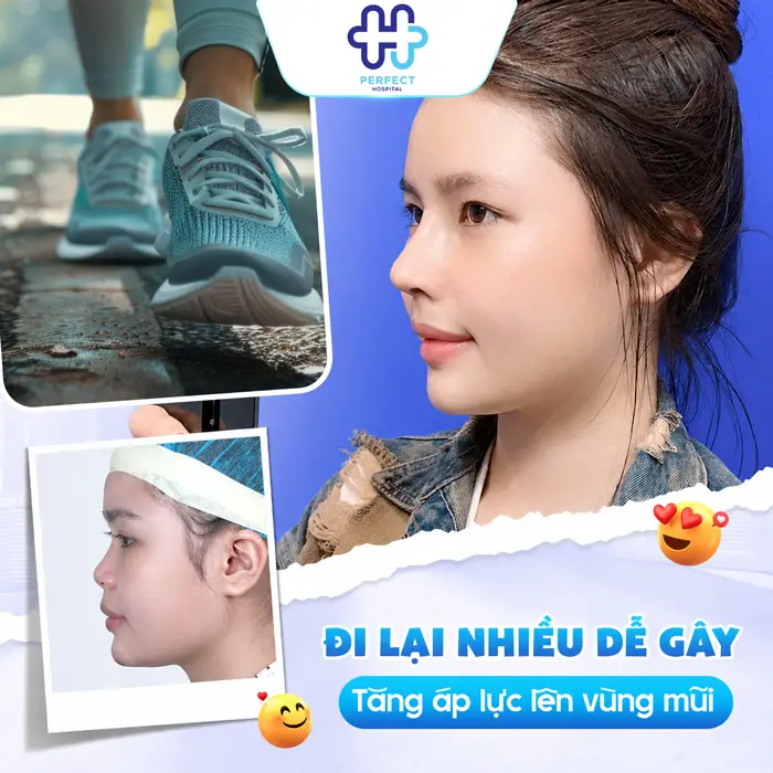 Nâng Mũi Có Nên Đi Lại Nhiều Không? Hướng Dẫn Vận Động Đúng Cách Sau Phẫu Thuật