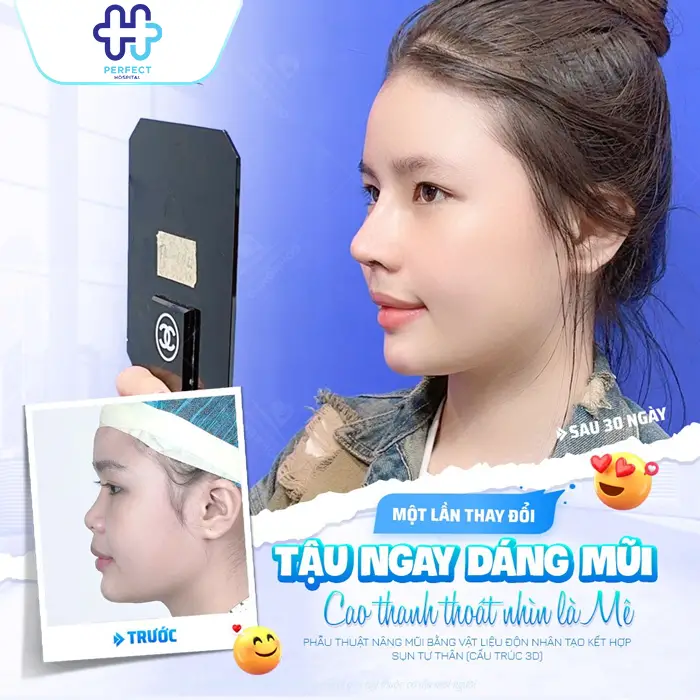 Nâng Mũi Có Thay Đổi Khuôn Mặt Không? Phân Tích Chi Tiết Từ Góc Nhìn Thẩm Mỹ
