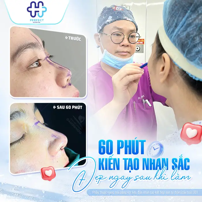 Nâng Mũi Có Thay Đổi Khuôn Mặt Không? Phân Tích Chi Tiết Từ Góc Nhìn Thẩm Mỹ