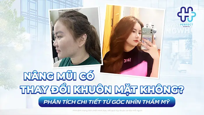 Nâng Mũi Có Thay Đổi Khuôn Mặt Không? Phân Tích Chi Tiết Từ Góc Nhìn Thẩm Mỹ