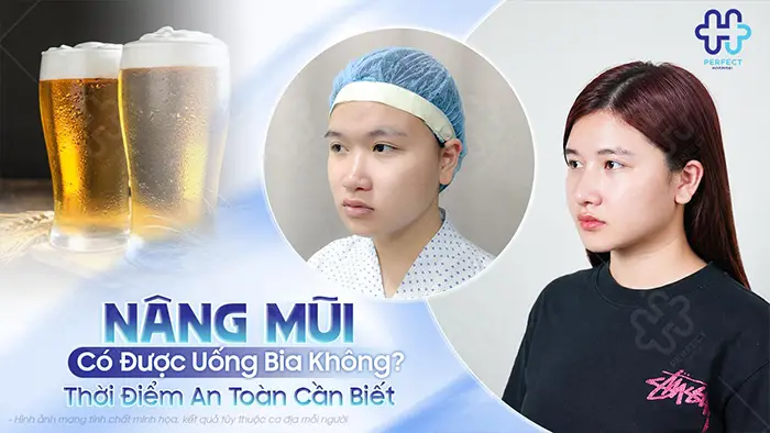 Nâng Mũi Có Được Uống Bia Không? Thời Điểm An Toàn Cần Biết