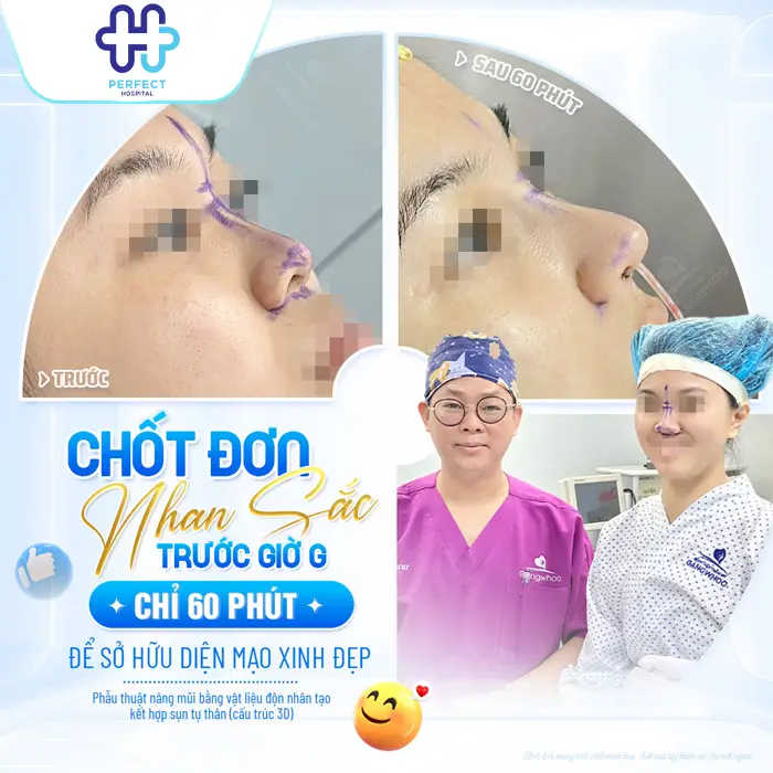 Nâng Mũi Có Vĩnh Viễn Không? Bao Lâu Thì Cần Làm Lại