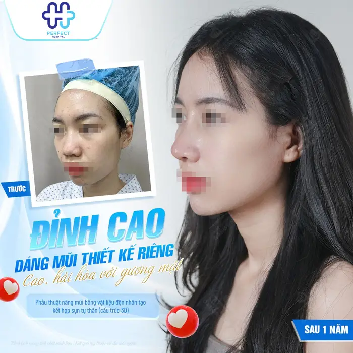 Nâng mũi Đà Nẵng ở đâu đẹp? Top 7+ Địa Chỉ Uy Tín