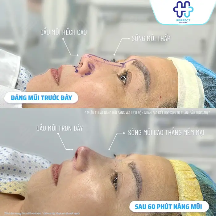 Nâng mũi Đà Nẵng ở đâu đẹp? Top 7+ Địa Chỉ Uy Tín