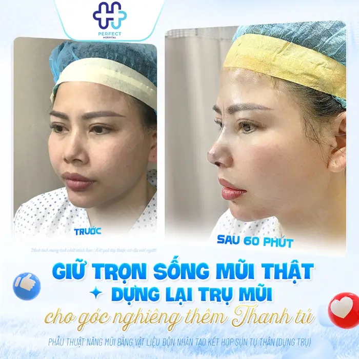 Nâng mũi Đà Nẵng ở đâu đẹp? Top 7+ Địa Chỉ Uy Tín