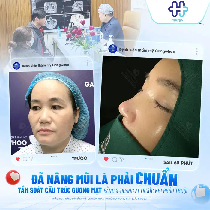 Nâng mũi Đà Nẵng ở đâu đẹp? Top 7+ Địa Chỉ Uy Tín