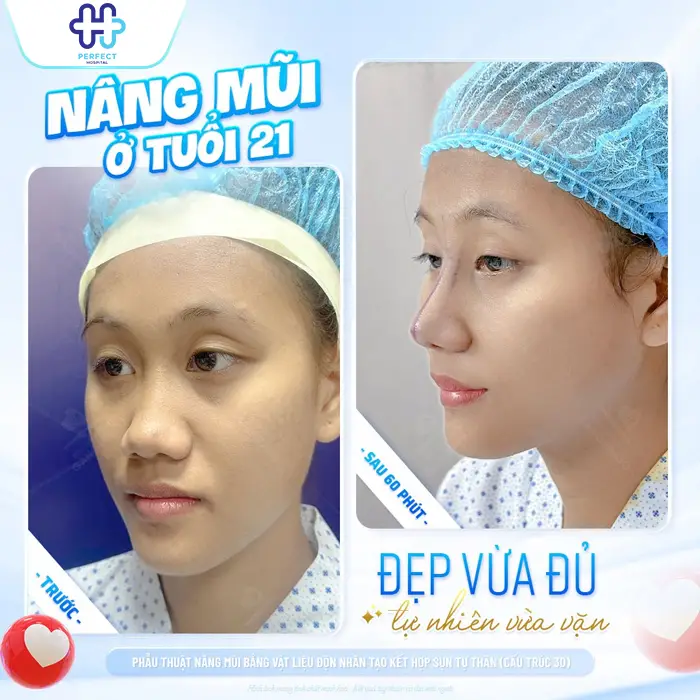 Nâng mũi Đà Nẵng ở đâu đẹp? Top 7+ Địa Chỉ Uy Tín