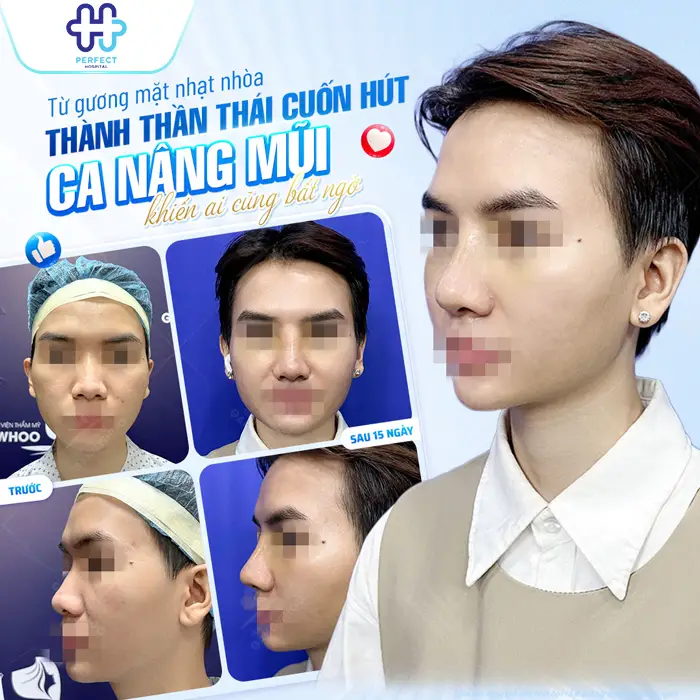 Nâng Mũi Gây Tê Hay Mê Lựa Chọn Nào An Toàn Và Phù Hợp