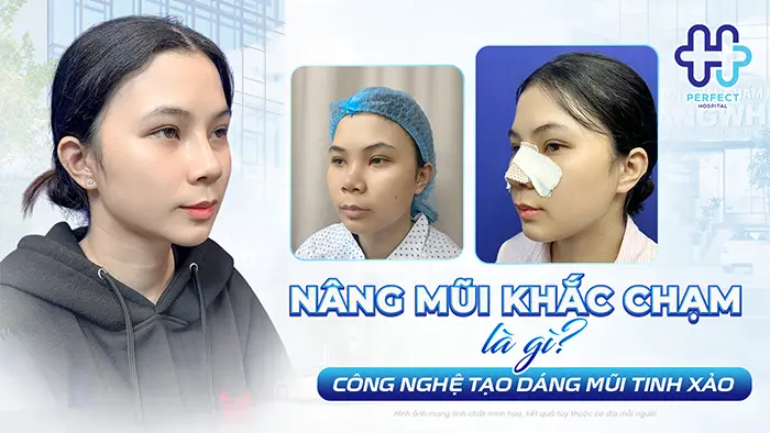 Nâng Mũi Khắc Chạm Là Gì? Công Nghệ Tạo Dáng Mũi Tinh Xảo